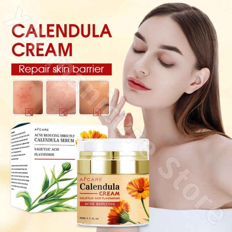 Memperbaiki Calendula Krim Pel - Luxury Skincare Whitening Cream ulasan dan harga